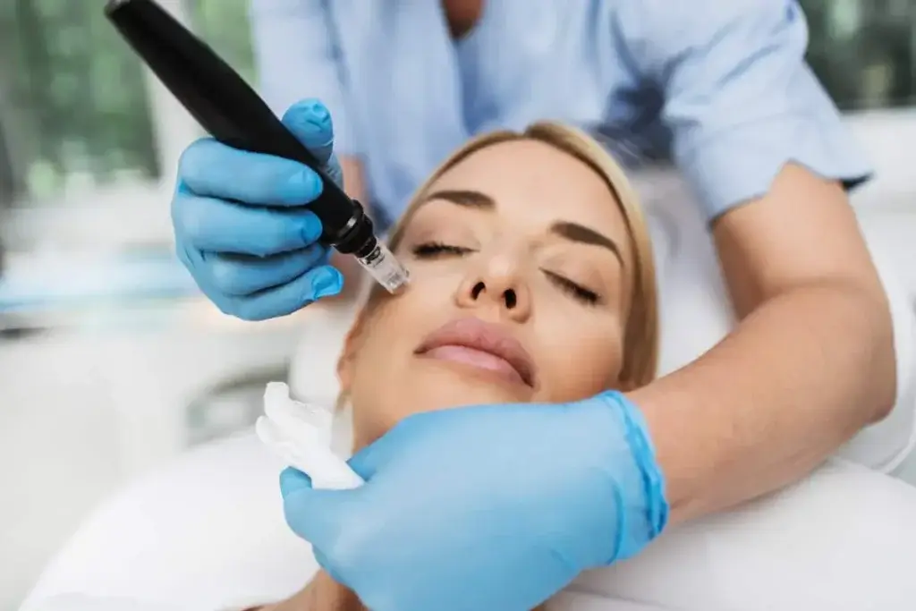 Microneedling in Zeeland, MI